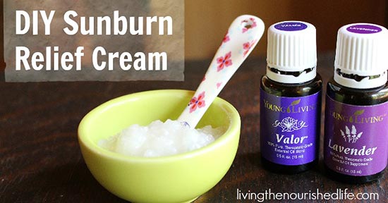 diy-sunburn-relief-cream