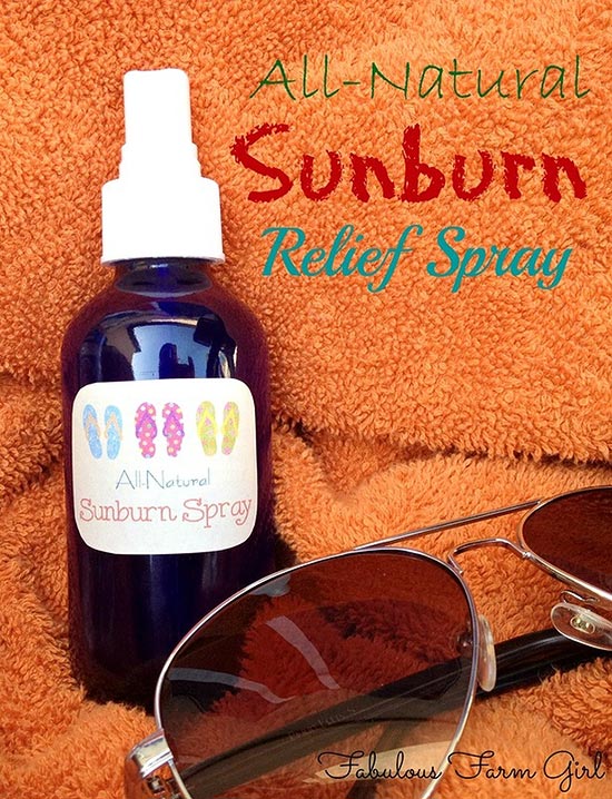 natural-sunburn-relief-spray